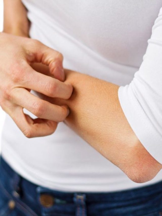 dry-itchy_201812176594