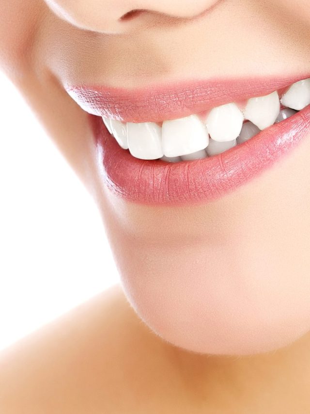 perfectly-white-teeth