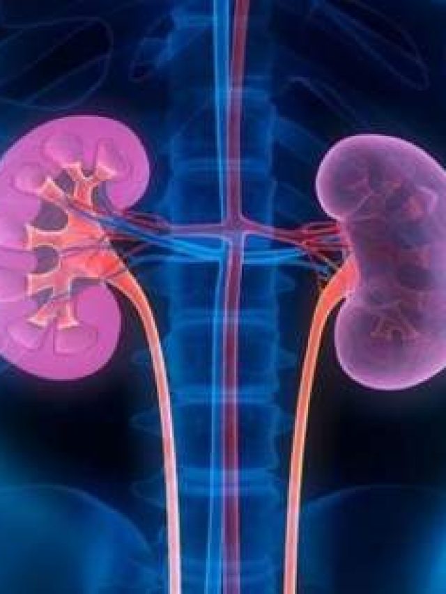 swollen-kidney_201812177194