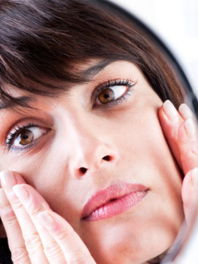 Undereye Dark Circles