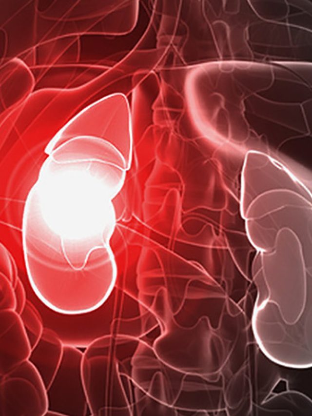 dt_140819_kidney_failure_800x600 tw