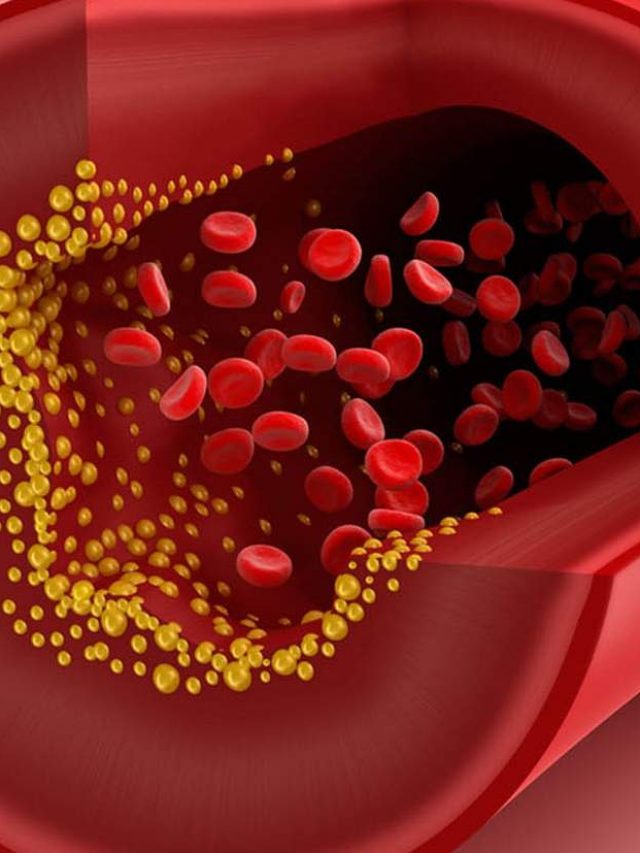 cholesterol-and-heart-disease6_201909300498