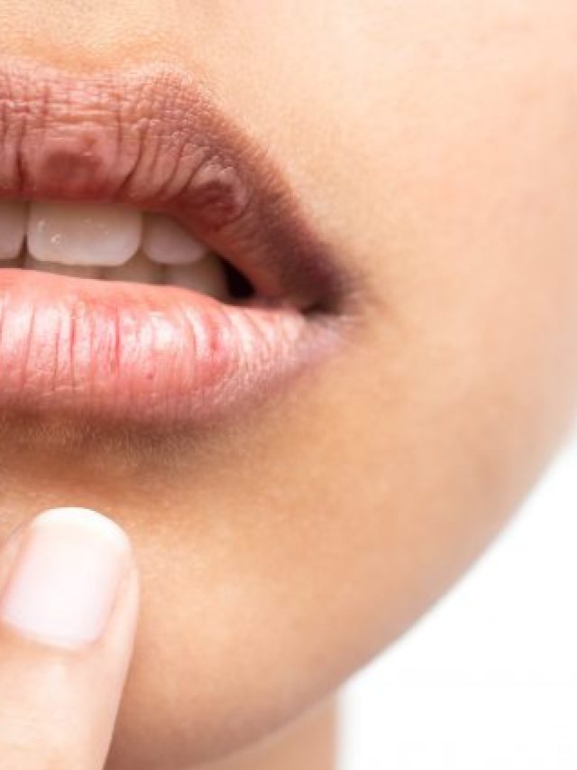 dry-mouth-syndrome-min-925x425