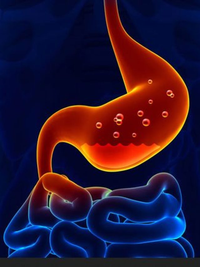 treatments-for-digestive-problems-500x500