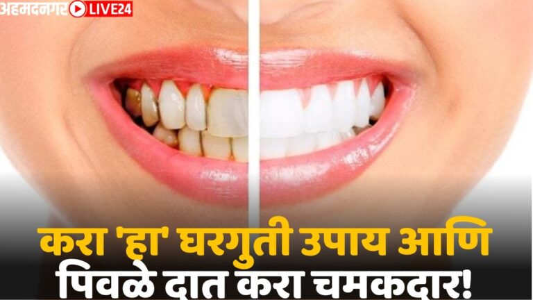 home remedies for whitening teeth