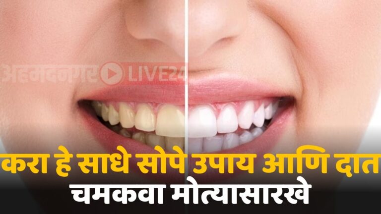 tips for whitening teeth