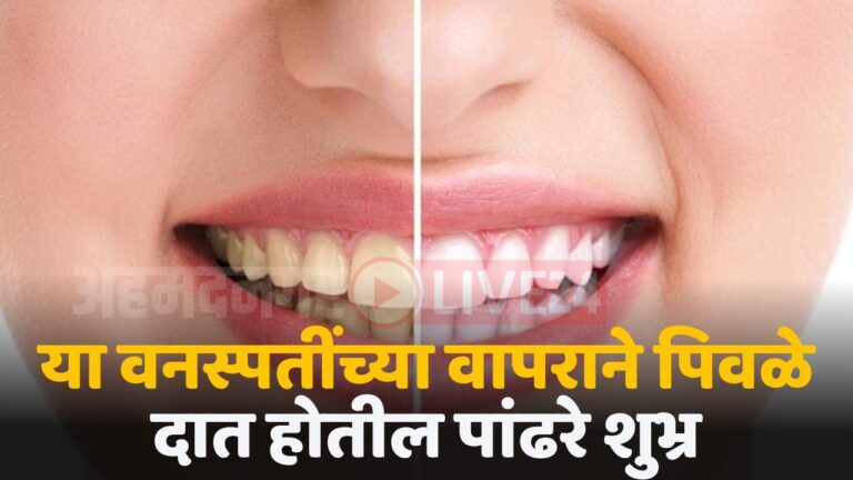 teeth care tips