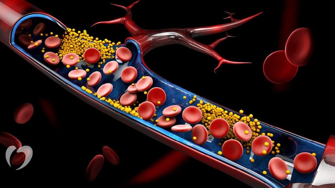 cholesterol